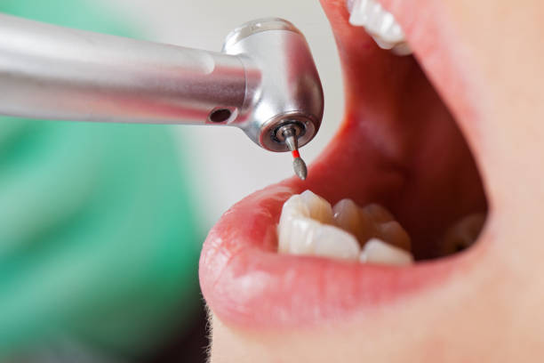 Best Urgent Care for Lost Fillings or Crowns in Stigler, OK